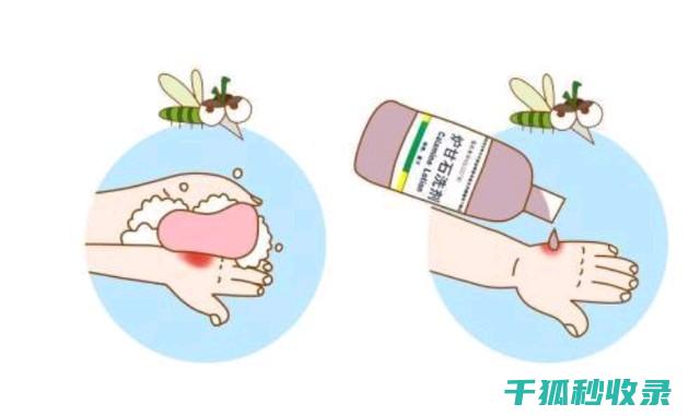 蚊虫叮咬后止痒，这些方法值得一试 (蚊虫叮咬后止痒)